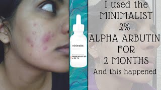 MINIMALIST ALPHA ARBUTIN 2 MONTH REVIEW [upl. by O'Neil26]