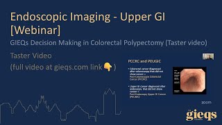 GIEQs Decision Making in Colorectal Polypectomy Taster video [upl. by Amabelle582]