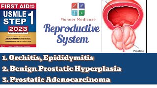 USMLE step 1 Epidimitis orchitis and BPH from First Aid Reproductive system pathUrduHindi [upl. by Coltun]