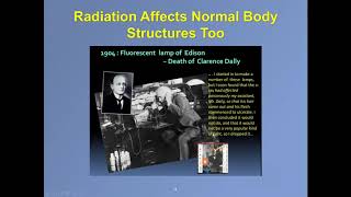 WEBINAR Radiation Therapy for Brain Tumors [upl. by Giddings8]