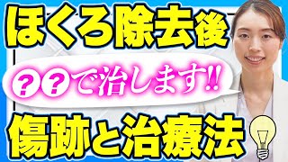 レーザーでほくろ除去後の傷跡にお悩みの方必見！形成外科専門医が解説する傷跡と治療法 きずときずあとのクリニック銀座院 [upl. by Mike680]