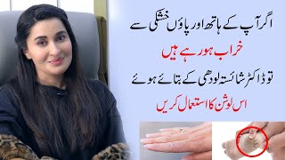 Best Solution for dry skin of hand and feet by Dr Shaista Lodhi  Ladies Talk [upl. by Eellac]