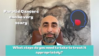 Parotid Cancers can be very scary  What steps do you need to take to treat it appropriately [upl. by Ime763]