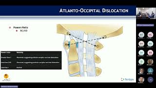 Occipitocervical Trauma  Gautham Prabhakar MD on September 23 2024 [upl. by Krawczyk783]