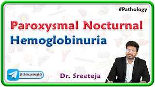 7 Paroxysmal Nocturnal Hemoglobinuria PNH  USMLE Step 1 Pathology [upl. by Ailen]