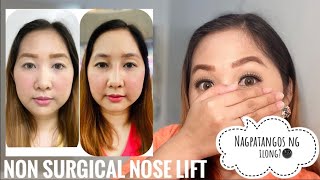 Non Surgical Nose Lift  Paano Magkano Saan Okay ba talaga [upl. by Burton]