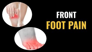 Front Foot Pain  Dr Donald Pelto  Worcester Podiatrist [upl. by Gluck]