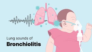 Sounds of Bronchiolitis  Lung Sounds [upl. by Erdnaid]