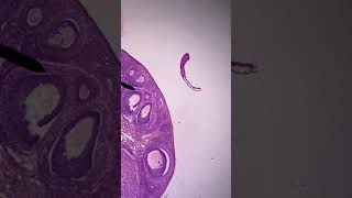 2402 Lab Ovary 2 Histology [upl. by Llenol]