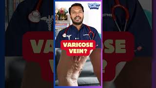 Say GOOD BYE to varicose vein Dr praveen Nithins homeopathy clinicvellore treatment shorts yt [upl. by Laeynad]