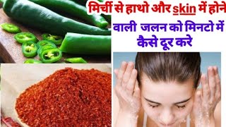 मिर्च से हाथों skin में होने वाली जलन को मिनटों में दूर करेंremove chilli burn from hands in Hindi [upl. by Atselec]