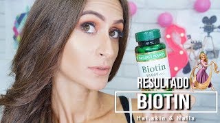 Resultado da Biotin 10000mg Biotina [upl. by Alleris]