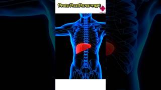 Liver Cirrhosis Symptom [upl. by Nace49]