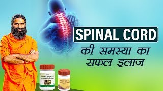 Ayurvedic Treatment for Spinal Cord  Swami Ramdev [upl. by Nauwtna]