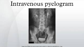 Intravenous pyelogram [upl. by Opiak58]