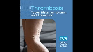 Thrombosis  Types Risks Symptoms and Prevention [upl. by Alhahs284]