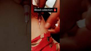 Syringe blood collection🩸💉 open system How to take blood from veins💉🩸bloodtest shorts status [upl. by Floro]