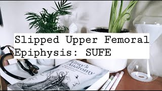 Slipped Upper Femoral Epiphysis  SUFE [upl. by Imoyik]