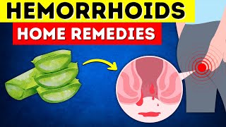 Say Goodbye to Hemorrhoids 8 Home Remedies That Actually Work [upl. by Yerot]