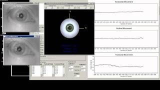 3D Video Oculography  Medical Eye Tracking [upl. by Emalee]