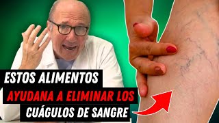 🔴Los 7 Mejores ALIMENTOS Que Derriten Los COÁGULOS De Sangre De Forma Natural [upl. by Mont]