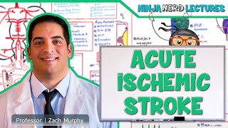 Acute Ischemic Stroke Etiology Pathophysiology Clinical Features Diagnostics Treatment [upl. by Rolph929]