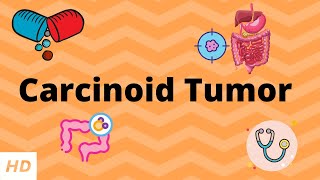 Carcinoid Tumor Causes Signs and Symptoms Diagnosis and Treatment [upl. by Milstone429]