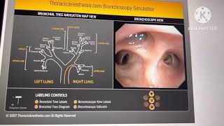 Broncoscopia simulador virtual [upl. by Deery]