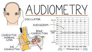 Understanding Audiometry and Audiograms [upl. by Maxima]