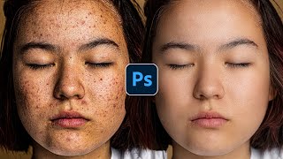 Face Retouching  Best Photoshop Tutorial  Skin Retouching 2024 [upl. by Torrance455]