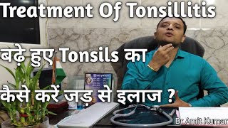 Treatment Of Tonsillitis  बढ़े हुए Tonsils का कैसे करें जड़ से इलाज Tonsils का इलाज। [upl. by Nicolette]