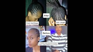 Before amp After using JT Hernox Hair Booster trendingnow hairtreatment hairtrends [upl. by Attennyl]