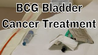 BCG Treatment for early Bladder Cancer chemo May 2016old version [upl. by Clarisa]