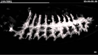 ショウジョウバエ胚の気管発生 [upl. by Duston]
