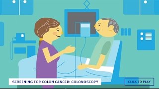 Screening for Colon Cancer Colonoscopy English [upl. by Gibert]