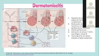 DERMATOMIOSITIS Y POLIOMIOSITIS [upl. by Adnilg201]