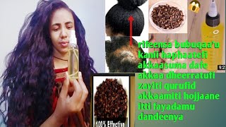 rifeensa buqaaufii cicitufii zayiti qurufudi fayaadamun ittisu nidandenya clove oli for hairgrowth [upl. by Huba]