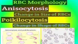 RBC MORPHOLOGY What is Anisocytosis What is Poikilocytosis [upl. by Eberhard673]