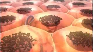 From Melanocyte to Melanoma [upl. by Edwine]