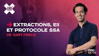 🔴 LIVE  Le Dr Gary Finelle nous parle extractions EII et protocole SSA [upl. by Frentz341]