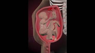 TWINS Nuchal cord  umbilical cord becomes wrapped around the fetal neck 360 degrees3D Animation [upl. by Anohr15]