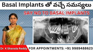 Basal Implants తో వచ్చే సమస్యలు  SAY NO TO BASAL IMPLANTS [upl. by Assilam919]