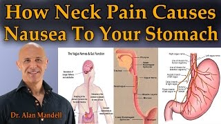 How Neck Pain Causes Nausea To Your Stomach  Dr Mandell [upl. by Ayotas]