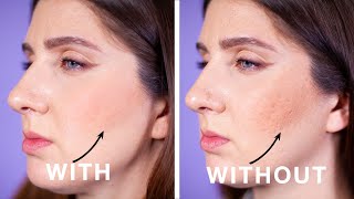 Simple Powder Trick For Pitted Acne Scars [upl. by Anytsirhc]