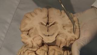 Cortical Localization Neuroanatomy Video Lab  Brain Dissections [upl. by Marlowe]