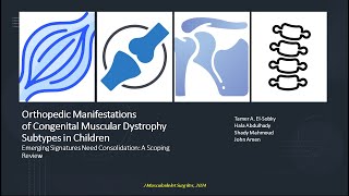 Orthopedic manifestations of congenital muscular dystrophies in children [upl. by Airemat432]