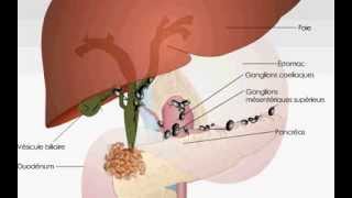 Obstruction des voies biliaires [upl. by Ahsilla738]