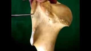 شرح عظمة ال humerus [upl. by Petite]