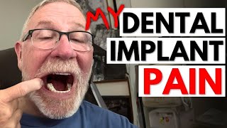 What I Wish I Knew Before My Dental Implant Surgery [upl. by Naol]