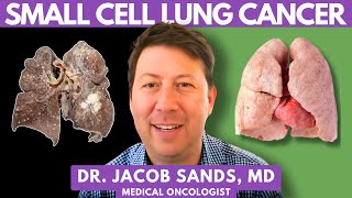 Small Cell Lung Cancer Treatment  Dr Jacob Sands MD [upl. by Enomar]